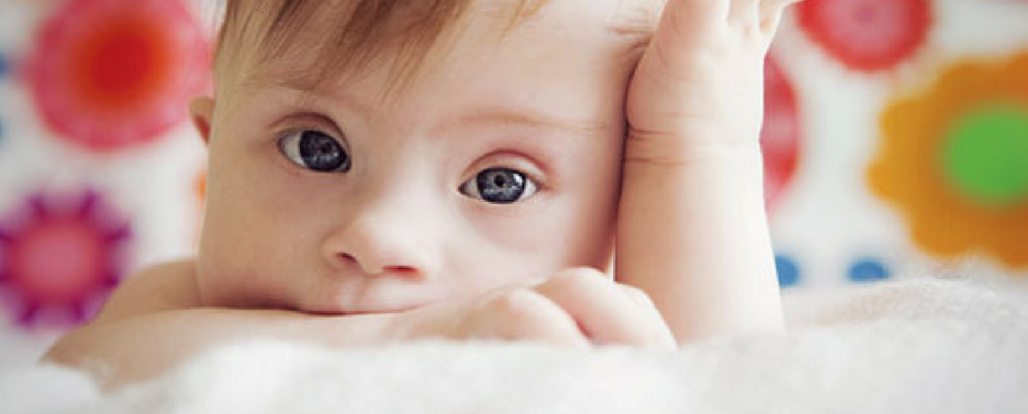 Stoppt das Töten von Down Kindern
